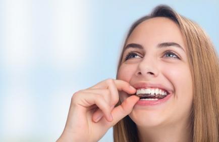 Invisalign ou Lingual, quel traitement choisir